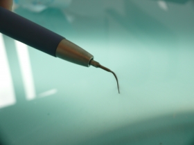 Endodonzia - Dr med dent Wolfgang Hornstein